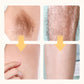 Armpit Hair Easy Trimmer